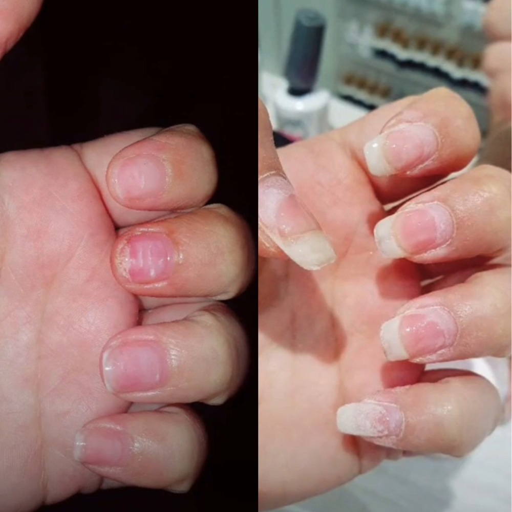 NAIL GROWTH OIL