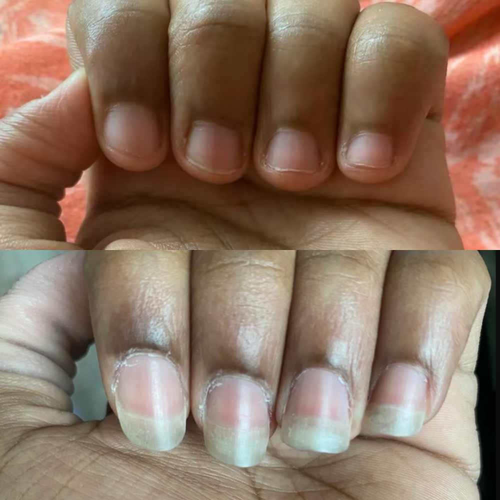 NAIL GROWTH OIL